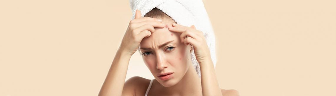 How To Stop Acne?