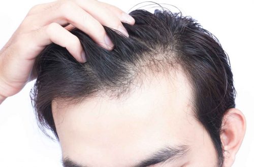 Causes Of Hair Loss